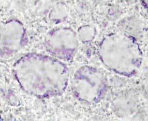 stains (β, ε) and N-acetyl-β-hexosaminidase histochemistry (γ, ζ).