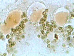 ότι οι κόκκοι λιποφουσκίνης εντοπίζονται κυρίως στο κυτταρόπλασμα (Εικ. 22). Σε ορισμένους ιστούς οι λιποφουσκίνες φάνηκε να καταλαμβάνουν ολόκληρες κυτταροπλασματικές περιοχές (Εικ. 23 α, ε).