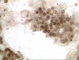 Schmrol reaction for the detection of lipofuscins (α, ε - arrows), staining