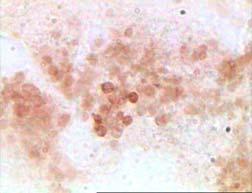 N-acetyl-βhexosaminidase histochemistry (δ, θ).