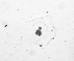 ΥΛΙΚΑ ΚΑΙ ΜΕΘΟΔΟΙ μικροπυρήνα, καθώς και κυττάρων που εμφάνισαν ταυτόχρονα δύο μικροπυρήνες, κυττάρων με δύο ξεχωριστούς πυρήνες και κυττάρων με πυρήνες