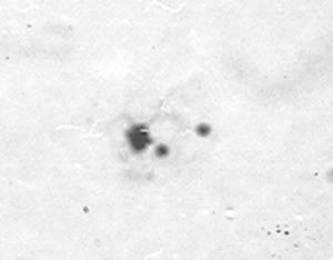 galloprovincialis που εμφανίζουν ένα μικροπυρήνα (α βέλος), δύο μικροπυρήνες ταυτόχρονα (β - βέλη), δύο ξεχωριστούς πυρήνες (γ - βέλη) και πυρήνα σχήματος