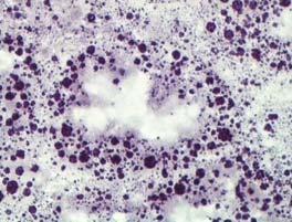 Histochemistry for the lysosomal enzyme N-acetyl-β-hexosaminidase in cryosections of the