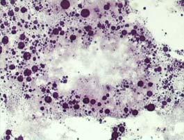 lysosomal enzyme