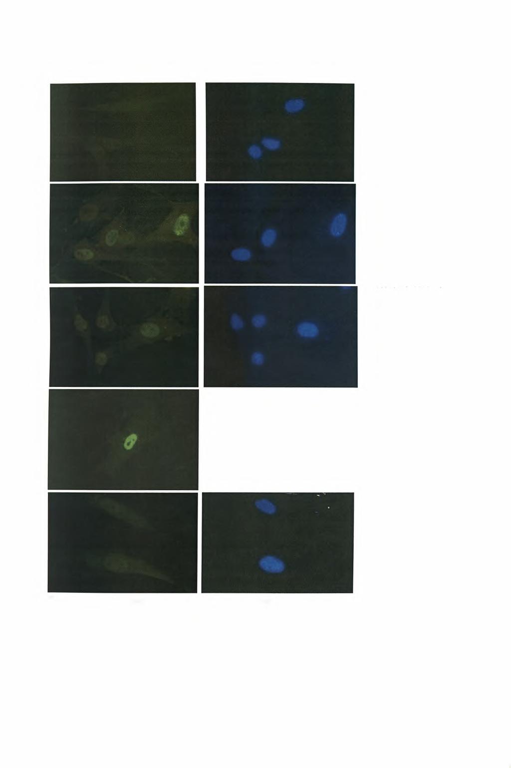 anti-hif-ια DAPI Μάρτυρας CoCl2 Hypoxia 1% DFO Ach Εικόνα 16.