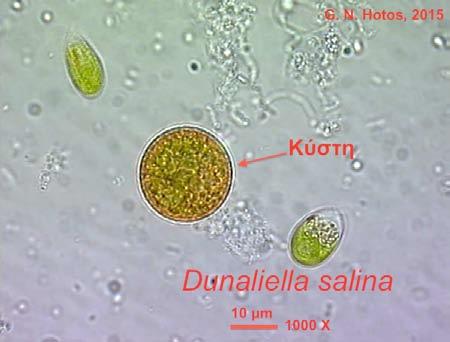 Χώτος): Dunaliella salina σε διάφορα στάδια και μορφές. Επάνω αριστερά: πράσινα κύτταρα με ποικιλία μεγεθών και σε κυτταρική διαίρεση.
