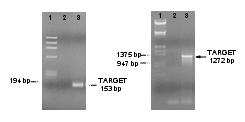 Μέθοδοι ανάλυσης προϊόντων PCR (1) Μη ειδικές για συγκεκριμένη