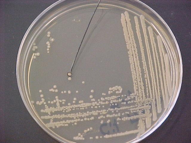 nutrient agar.