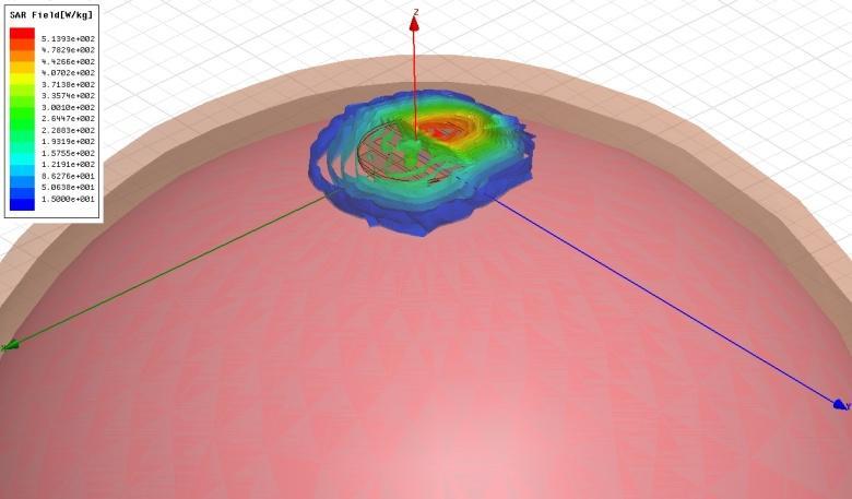 ηλεκτρολόγων και ηλεκτρονικών μηχανικών (IEEE), SAR< 1,6 W/Kg για ένα γραμμάριο βιολογικού ιστού [47] και SAR< 2 W/Kg για 10 γραμμάρια ιστού [48].