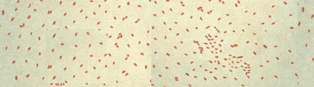Bordetella pertussis Η PTX μεηαθένεη ηεκ ADP-νηβυδε ζε μηα Cys ηεξ Gai πμο