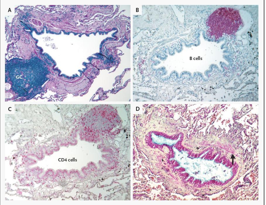 Lymphoid follicles: CD4+ T-cells and B-cells Hogg