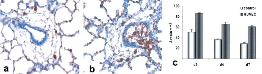 CD4+ θπηηάξα ζε πλεύκνλεο αξνπξαίσλ αλνζνπνηεκέλσλ κε