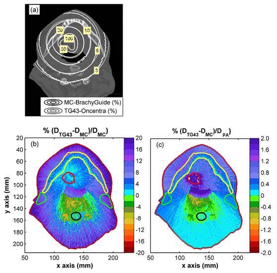 Εικόνα B.5.4. Σύγκριση TG-43 και εξατομικευμένης (Monte Carlo) δοσιμετρίας στην κεντρική εγκάρσια τομή του PTV για έναν αντιπροσωπευτικό ασθενή.
