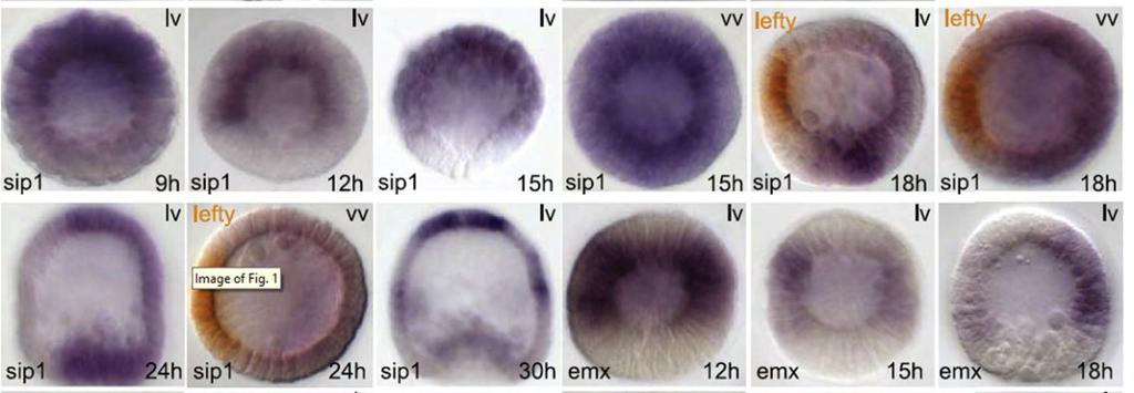 μετάγραφα του Sip1 ενεργοποιούνται στο αντιστοματικό μεσόδερμα ξεκινώντας από το στάδιο του μεσεγχυματικού βλαστιδίου. Εικόνα 37: Απεικόνιση της έκφρασης του μεταγραφικού παράγοντα Sip1(Li et al.