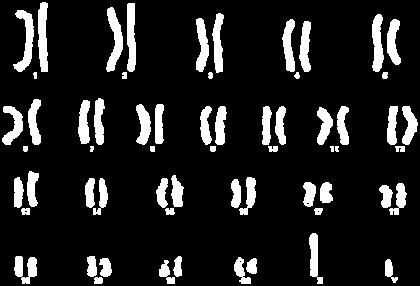 Εικόνα 3.7: Καρυότυπος αρσενικού ατόμου. Εικόνα 3.8: Καρυότυπος θηλυκού ατόμου.