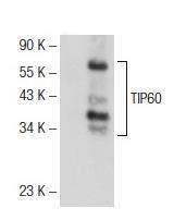 Αποτελέσματα της Tip60 είναι παρόμοια και στις συνθήκες CM και μετά την ενεργοποίηση των κυττάρων. Άρα η κυτταρική σειρά Jurkat προσομοιάζει τα παρθενικά Τ λεμφοκύτταρα.