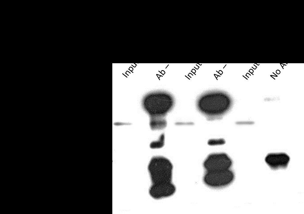 Αποτελέσματα Εικόνα 34 : Η ενδογενής πρωτεΐνη Τip60 αλληλεπιδρά με την ενδογενή πρωτεΐνη Ets-2. Πρωτεϊνικά εκχυλίσματα από την κυτταρική σειρά Jurkat επωάστηκαν με αντίσωμα έναντι της πρωτεΐνης Τip60.