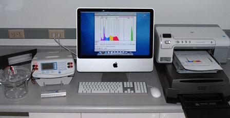 Lipoprint LDL subclass analysis A