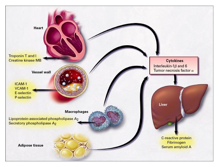 Markers of inflammation and myocardial