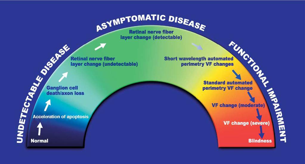 1.9 Η εξέλιξη του γλαυκώματος Η εξέλιξη του γλαυκώματος παθοφυσιολογικά διακρίνεται σε διάφορα στάδια ως μια συνέχεια η οποία χαρακτηρίζεται από επιταχυνόμενη απώλεια των γαγγλιακών κυττάρων του