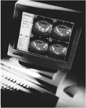 1η φάση 1980-1988: αρχικά πειράματα λειτουργικότητα λήψη αποθήκευση παρουσίαση αρχιτεκτονική μεμονωμένα συστήματα καμία