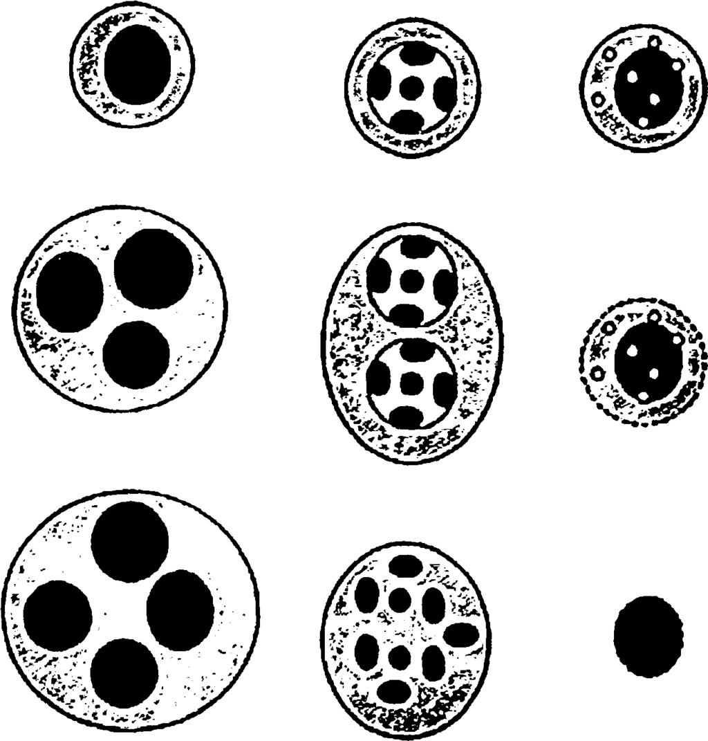 ο) μονο- και β) αποπτωτικά γ) νεκρά πολυπύρηνα κύτταρα κύττορο κύτταρα Εικόνα 8. Διάφοροι τύποι κυττάρων που μπορούν να παρατηρηθούν σε ένα παρασκεύασμα CBMN.