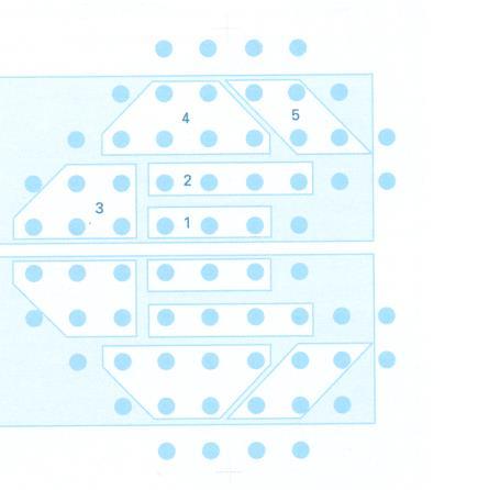 "Glaucoma hemifield test". Τα δύο από αυτά το "bordeline" και το "general reduction of sensitivity" μπορούν να εμφανιστούν ταυτόχρονα. 1.