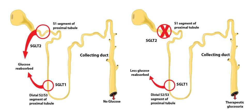 Εισαγωγή στην Canagliflozin Μηχανισμός Δράσης Nomura S, et al. J Med Chem. 2010;53(17):6355-6360. Rosenstock J, et al. Diabetes Care. 2012;35(6):1232-1238. Sha S, et al. Diabetes Obes Metab.