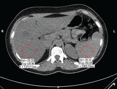 patients with or without metabolic syndrome.