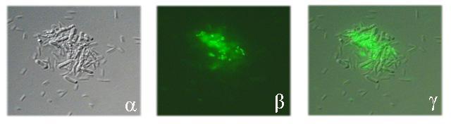 ε ακηίεεζδ ιε ημκ B.thuringiensis, μ πθδεοζιυξ ημο ααηηδνζαημφ ζηεθέπμοξ P.A1 δε ιεηααθήεδηε ηαηά ηδ δζάνηεζα ημο πεζνάιαημξ. (α) Καηά ηδκ έκανλδ ηδξ επχαζδξ ημ ααηηδνζαηυ ζηέθεπμξ P.