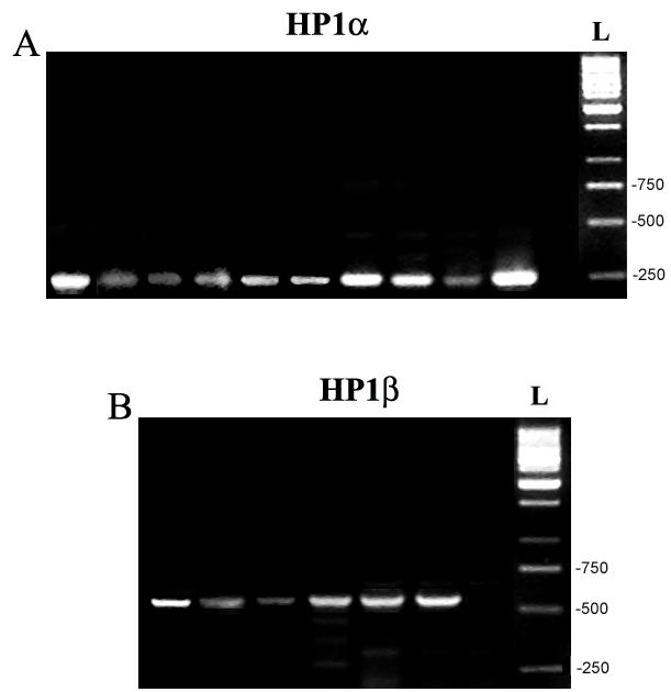 Εικόνα 6. RT-PCR σε υλικό από λεµφώµατα ασθενών. (Α) Η περιοχή που έχει «πολλαπλασιαστεί» αντιστοιχεί στα νουκλεοτίδια 416-679, που βρίσκονται µετά τον χρωµοτοµέα (CD) της HP1α.
