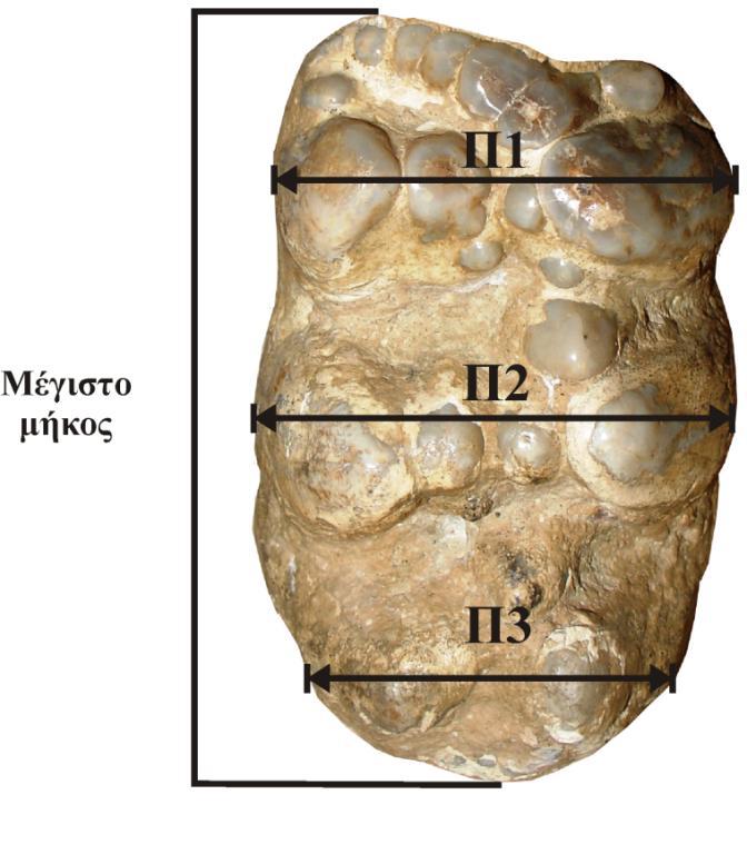 : foramen alveolare posterior, οπίσθιο φατνιακό τρήμα F. ment.: foramen mentalia, γενειακό τρήμα Pr. cor.