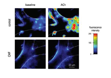 capillary injury in cardiovascular