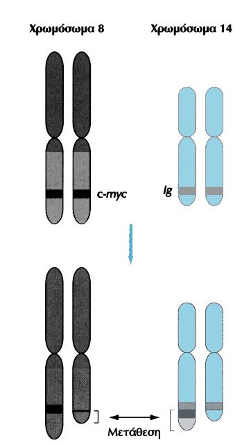 Σφάλματα στην αναδιάταξη των γονιδίων των ανοσοσφαιρινών Ανάπτυξη λευχαιμιών και λεμφωμάτων Λέμφωμα Burki μετάθεση του πρωτο-ογκογονιδίου c-myc στον τόπο των βαριών