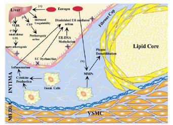 Harmful effects of estrogen in vessels with established atherosclerotic plaques expression of estrogen receptors ER-mediated action of estrogens