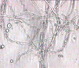 trispora (10 η ηµέρα ζύµωσης) που αναπτύσσεται µε συνεχή προσθήκη του υποστρώµατος τροφοδοσίας 5 ή 6 µε ρυθµό 4,2 ml/h από την