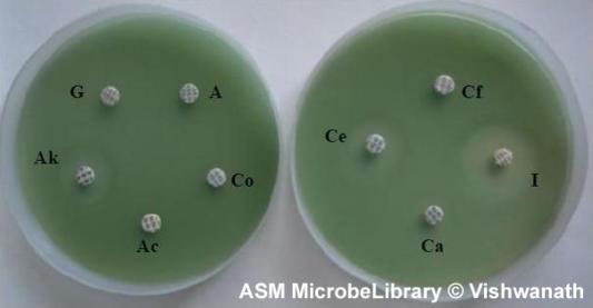 Pseudomonas aeruginosa ampicillin (A), cefotaxime (Ce), co-trimoxazole (Co), ciprofloxacin