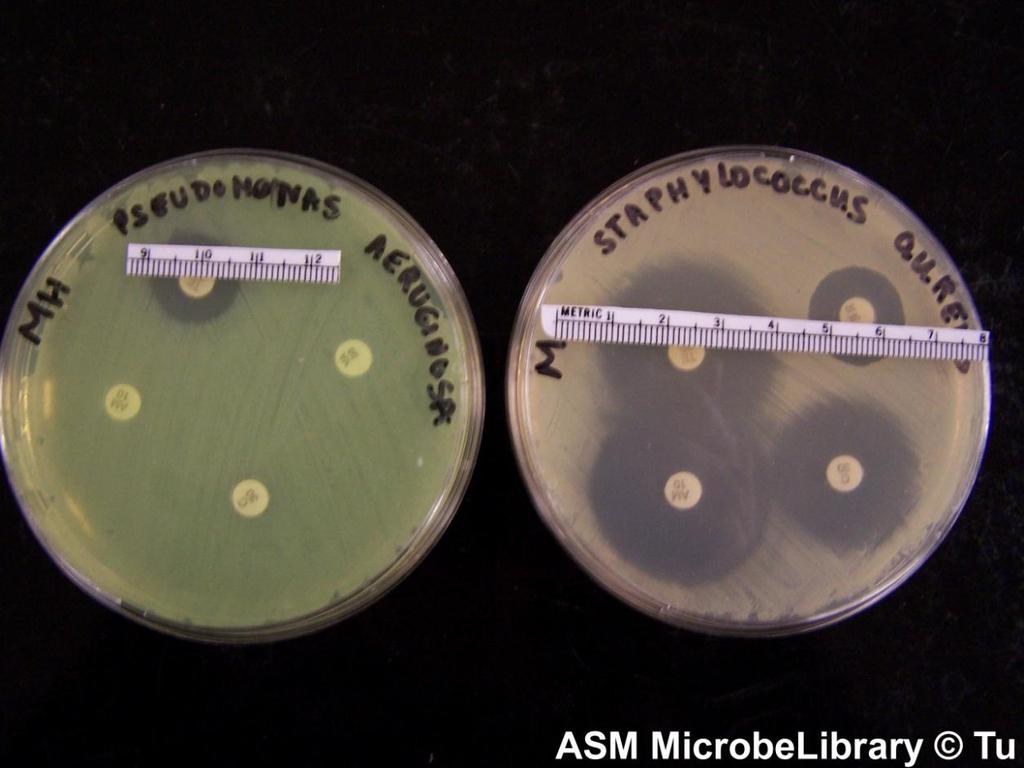 30 µg of tetracycline (top left), 30 µg of vancomycin (top right), 10 µg