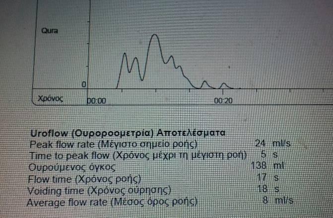 λιγότερο συχνά απόφραξη Άλλες αιτίες υποκυστικής απόφραξης: από ότι πιστεύεται 1)πτωχή