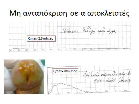 ΑΞΙΟΛΟΓΗΣΗ Male-LUTS Ατομικό ιστορικό. Φαρμακευτικό Ιστορικό. Χειρουργικό Ιστορικό.* Γενική εξέταση ούρων. Ουρία, Κρεατινίνη. Κλινική εξέταση.** Αξιολόγηση LUTS (IPSS).