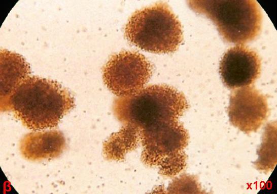 1 Φαινοτυπικός χαρακτηρισμός των προγονικών αιμοποιητικών κυττάρων των ανθρώπων Τα προγονικά αιμοποιητικά κύτταρα των καλλιεργειών