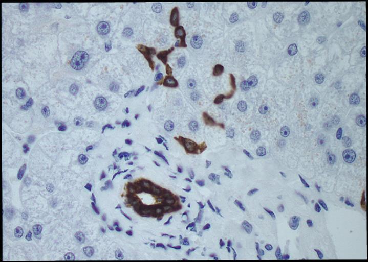 Ηπατικά αρχέγονα κύτταρα Canals of Hering Bile ductule Διφαινοτυπικά άωρα κύτταρα με δυναμικό με διττής διαφοροποίησης Εντόπιση (πιθανές φωλεές): πόροι του Hering, χολαγγειόλια, μικρά χολαγγεία