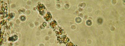 Κυανοβακτήρια:τα κυανοβακτήρια (ή κυανοφύκη) είναι µικροσκοπικοί προκαρυωτικοί φωτοσυνθετικοί