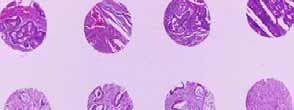 µ µ., µ HRP (super sensitive non-biotin detection system.
