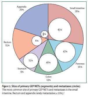 Νευροενδοκρινείς όγκοι 40-80% των NETs ανακαλύπτονται σε μεταστατικό στάδιο