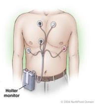 Cardiac Diagnostics