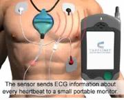 Insertable Cardiac