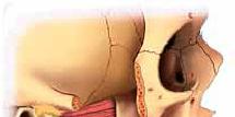 Εικόνα 4. Ο έξω πτερυγοειδής μυς (Mετασχεδίαση από Netter 2014). Ο έσω πτερυγοειδής βρίσκεται στην έσω επιφάνεια του κλάδου και έχει την ίδια διεύθυνση με τον μασητήρα.