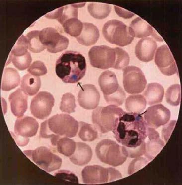 weakly basophilic cytoplasmic inclusion that is composed of stacks of