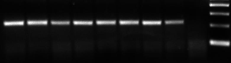 περιπτώσεις ασθενών ACT LEPR isoform 2 1 4 6 7 8 9 1 + + + + + + + + - + + + - + + (+ 221b 114b LEPR isoform LEPR isoform + + + + + + + +